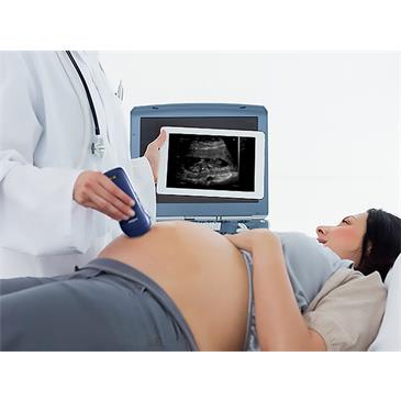 Ecógrafo portátil inalámbrico 3 en 1 con sonda lineal, convexa y cardíaca